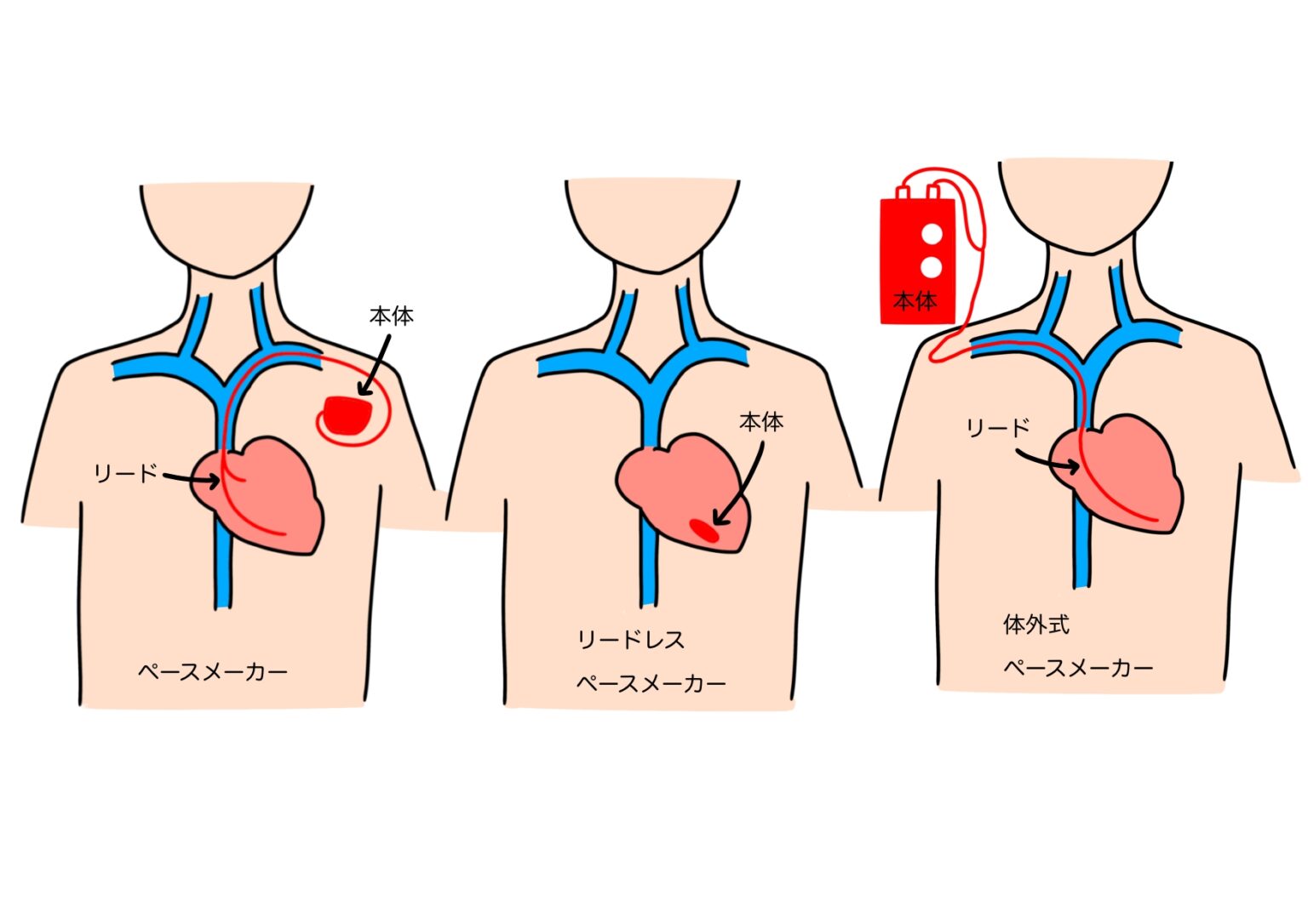 心不全とCKDの診断