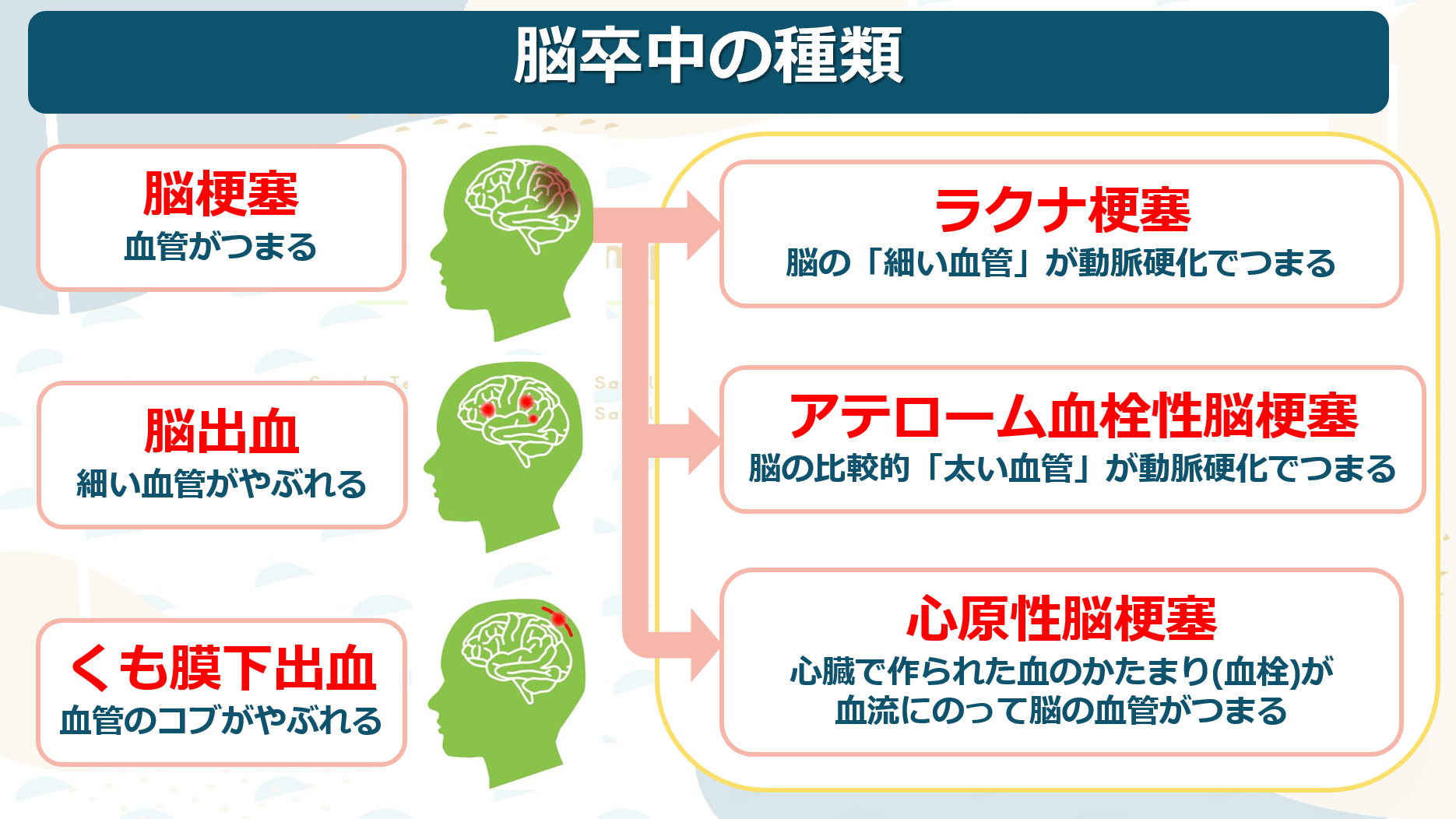 脳卒中とは | 3つのタイプと違いについて分かりやすく解説 | ぴんころ