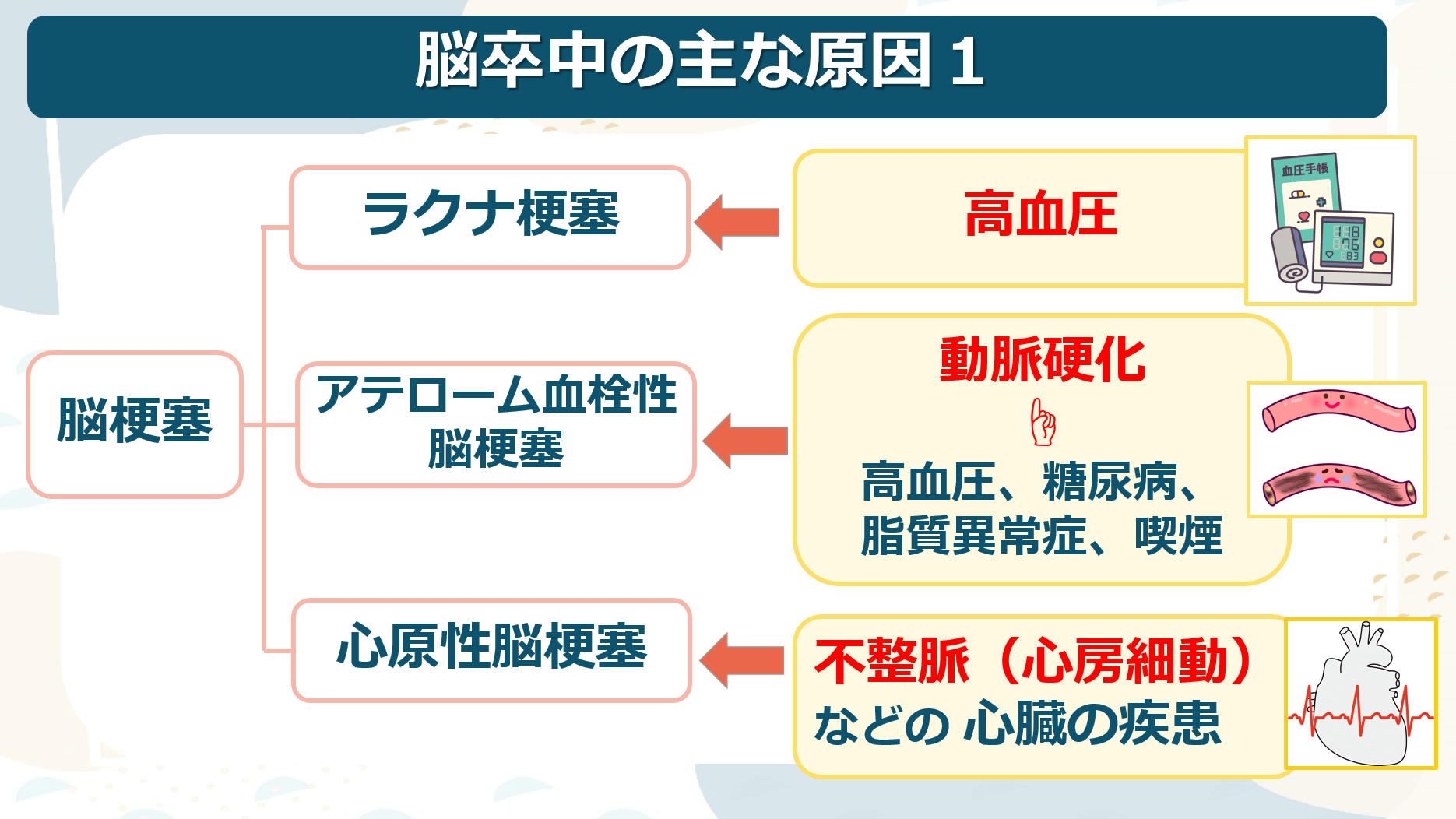 脳卒中とは | 3つのタイプと違いについて分かりやすく解説 | ぴんころ